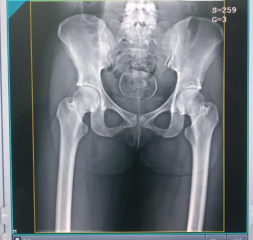 Polícia Penal flagra mulher tentando entrar com drogas no Copemcan